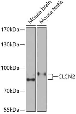 Western Blot: CLCN2 Antibody [NBP2-92467] - Analysis of extracts of various cell lines, using CLCN2 at 1:1000 dilution.Secondary antibody: HRP Goat Anti-Rabbit IgG (H+L) at 1:10000 dilution.Lysates/proteins: 25ug per lane.Blocking buffer: 3% nonfat dry milk in TBST.Detection: ECL Basic Kit .Exposure time: 90s.