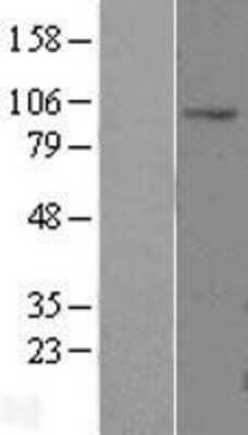 Western Blot: CLCN2 Overexpression Lysate (Adult Normal) [NBL1-09233] Left-Empty vector transfected control cell lysate (HEK293 cell lysate); Right -Over-expression Lysate for CLCN2.