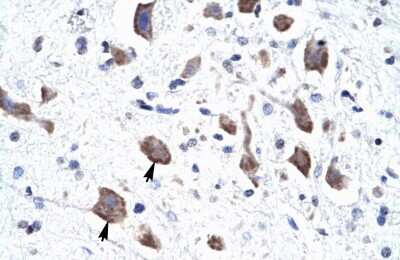 Immunohistochemistry: CLCN3 Antibody [NBP2-87193] - Human Brain