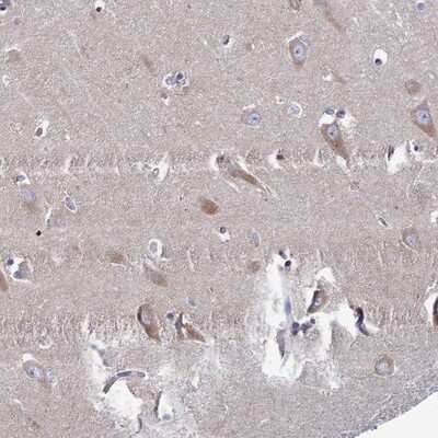 Immunohistochemistry-Paraffin: CLCN3 Antibody [NBP1-91790] - Staining of human hippocampus shows moderate cytoplasmic positivity in neuronal cells.