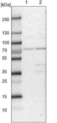 Western Blot: CLCN3 Antibody [NBP1-91790] - Lane 1: Mouse liver tissue lysate Lane 2: Rat liver tissue lysate. Recommended dilution: 1:250 - 1:500