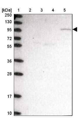 Western Blot: CLCN3 Antibody [NBP1-91790] - Lane 1: Marker  [kDa] 250, 130, 95, 72, 55, 36, 28, 17, 10.  Lane 2: Human cell line RT-4.  Lane 3: Human cell line U-251MG sp.  Lane 4: Human plasma (IgG/HSA depleted).  Lane 5: Human liver tissue