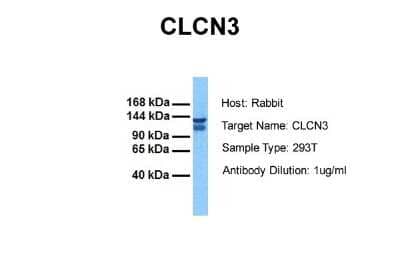 Western Blot: CLCN3 Antibody [NBP2-87193] - Host: Rabbit. Target Name: CLCN3. Sample Tissue: Human 293T. Antibody Dilution: 1.0ug/ml