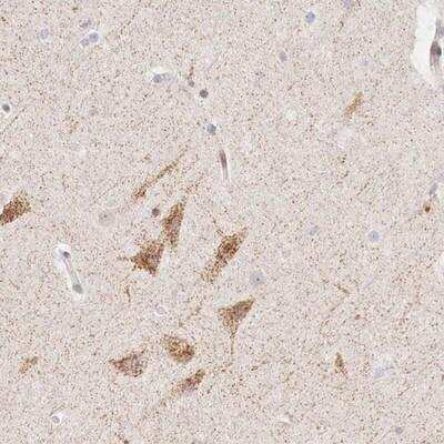 Immunohistochemistry-Paraffin CLCN5 Antibody