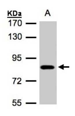 Western Blot: CLCN5 Antibody [NBP1-32302] - Sample(30 ug of whole cell lysate) A:A431 7. 5% SDS PAGE, antibody diluted at 1:500.