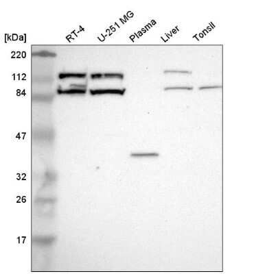 Western Blot CLCN5 Antibody