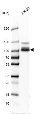 Western Blot: CLCN5 Antibody [NBP2-58621] - Analysis in human cell line RH-30.