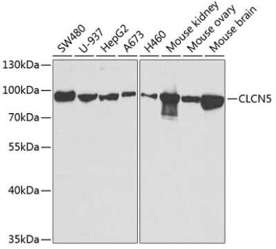 Western Blot: CLCN5 Antibody [NBP2-92656] - Analysis of extracts of various cell lines, using CLCN5 at 1:1000 dilution.Secondary antibody: HRP Goat Anti-Rabbit IgG (H+L) at 1:10000 dilution.Lysates/proteins: 25ug per lane.Blocking buffer: 3% nonfat dry milk in TBST.Detection: ECL Basic Kit .Exposure time: 90s.