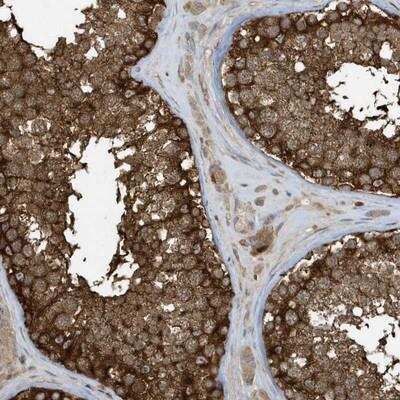 Immunohistochemistry-Paraffin CLCN6 Antibody - BSA Free