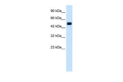 Western Blot: CLCN6 Antibody [NBP2-84690] - WB Suggested Anti-CLCN6 Antibody Titration: 1.25ug/ml. ELISA Titer: 1:62500. Positive Control: Jurkat cell lysate