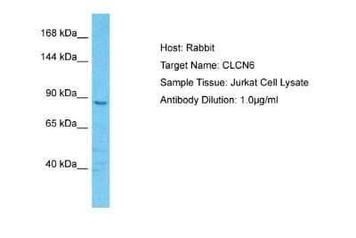 Western Blot: CLCN6 Antibody [NBP2-84691] - Host: Rabbit. Target Name: CLCN6. Sample Type: Jurkat Whole Cell lysates. Antibody Dilution: 1.0ug/ml