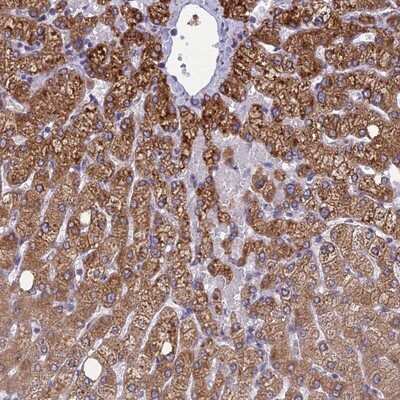 Immunohistochemistry-Paraffin: CLCN7 Antibody [NBP1-91792] - Staining of human liver shows strong cytoplasmic positivity in hepatocytes.