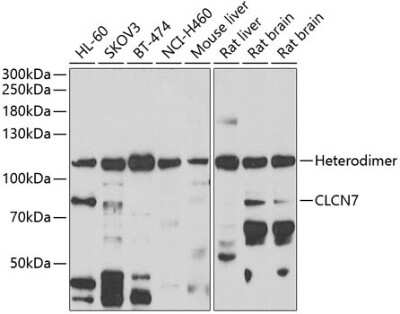 Western Blot CLCN7 Antibody - BSA Free