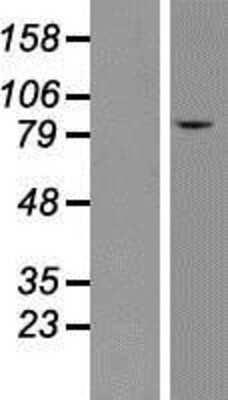 Western Blot: CLCN7 Overexpression Lysate (Adult Normal) [NBP2-08221] Left-Empty vector transfected control cell lysate (HEK293 cell lysate); Right -Over-expression Lysate for CLCN7.