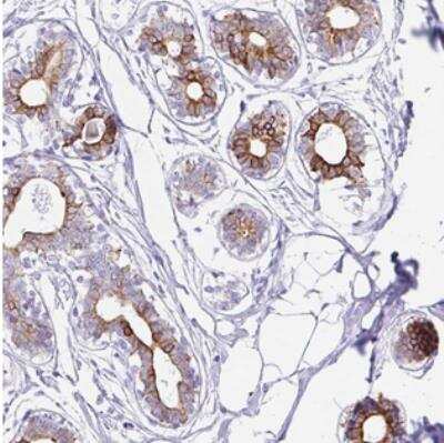 Immunohistochemistry-Paraffin CLDND2 Antibody - BSA Free