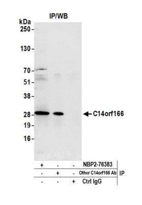 Immunoprecipitation: CLE7 homolog Antibody [NBP2-76383] - Detection of human C14orf166 by western blot of immunoprecipitates. Samples: Whole cell lysate (1.0 mg per IP reaction; 20% of IP loaded) from Jurkat cells prepared using NETN lysis buffer. Antibodies: Affinity purified rabbit anti-C14orf166 antibody NBP2-76383 used for IP at 100 ul per reaction. C14orf166 was also immunoprecipitated by another rabbit anti-C14orf166 antibody. For blotting immunoprecipitated C14orf166, NBP2-76383 was used at 1:100. Detection: Chemiluminescence with an exposure time of 10 seconds.