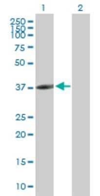 Western Blot: CLEC10A/CD301 Antibody [H00010462-B01P] - Analysis of CLEC10A expression in transfected 293T cell line by CLEC10A polyclonal antibody.  Lane 1: CLEC10A transfected lysate(34.76 KDa). Lane 2: Non-transfected lysate.