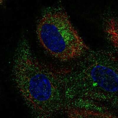 Immunocytochemistry/Immunofluorescence: CLEC14A Antibody [NBP2-56335] - Staining of human cell line HUVEC TERT2 shows localization to endoplasmic reticulum.