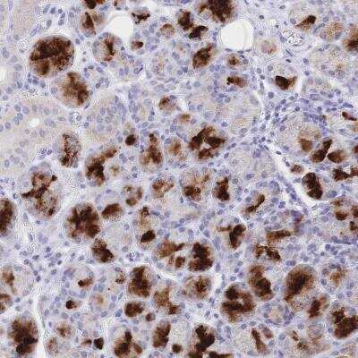 Immunohistochemistry: CLEC18B Antibody [NBP2-46765] - Staining of human salivary gland shows strong positivity in glandular cells along with distinct positivity of extracellular material.