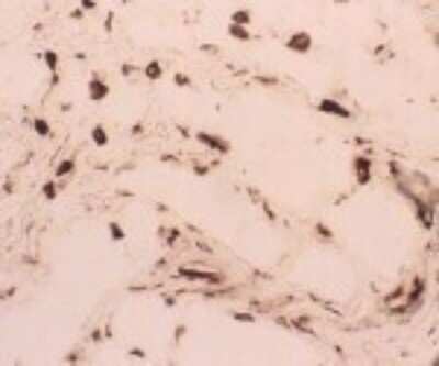 Immunohistochemistry CLEC18C Antibody (118F2.02)