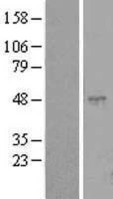 Western Blot: CLEC18C Overexpression Lysate (Adult Normal) [NBL1-13068] Left-Empty vector transfected control cell lysate (HEK293 cell lysate); Right -Over-expression Lysate for CLEC18C.