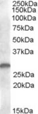 Western Blot: CLEC1B Antibody [NB100-93458] - (1ug/ml) staining of human kidney lysate (35ug protein in RIPA buffer). Primary incubation was 1 hour. Detected by chemiluminescence.