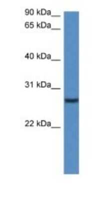 Western Blot: CLEC1B Antibody [NBP1-79203] - Titration: 1.0 ug/ml Positive Control: Mouse Pancreas.