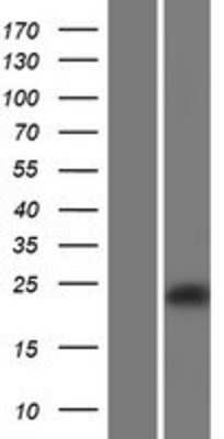 Western Blot: CLEC2D Overexpression Lysate (Adult Normal) [NBP2-08866] Left-Empty vector transfected control cell lysate (HEK293 cell lysate); Right -Over-expression Lysate for CLEC2D.