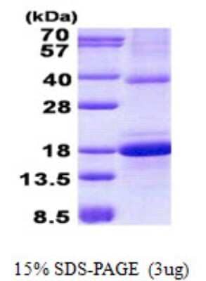 SDS-Page: Recombinant Human OCIL/CLEC2d Protein [NBP2-22966]