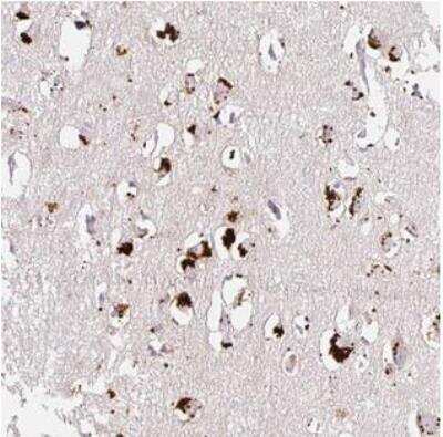 Immunohistochemistry-Paraffin: CLEC3A Antibody [NBP2-30595] - Staining of human cerebral cortex shows strong cytoplasmic positivity, with a granular pattern in neuronal cells.