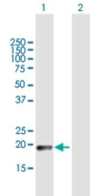 Western Blot: CLEC3A Antibody [H00010143-B01P] - Analysis of CLEC3A expression in transfected 293T cell line by CLEC3A polyclonal antibody.  Lane 1: CLEC3A transfected lysate(21.67 KDa). Lane 2: Non-transfected lysate.