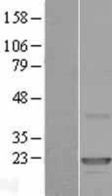 Western Blot: CLEC3A Overexpression Lysate (Adult Normal) [NBP2-07708] Left-Empty vector transfected control cell lysate (HEK293 cell lysate); Right -Over-expression Lysate for CLEC3A.