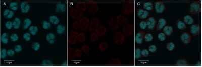 Immunocytochemistry/Immunofluorescence: CLEC3B/Tetranectin Antibody (5B7) - BSA Free [NBP1-05142] - For confocal microscopy, NBP1-05142 used to stain human neutrophils  A) DAPI-stained, B) tetranectin-stained, and C) overlay picture . Image courtesy of  Isabelle Naegelen, University of Luxemburg
