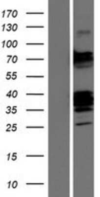 Western Blot: CLEC9A Overexpression Lysate (Adult Normal) [NBP2-04491] Left-Empty vector transfected control cell lysate (HEK293 cell lysate); Right -Over-expression Lysate for CLEC9A.