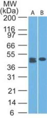 Western Blot: CLEC9a Antibody (14N8D7) - Azide and BSA Free [NBP2-80673] - Analysis of A) HCT-116 and B) MCF-7 lysate using this antibody at 1 ug/ml. Image from the standard format of this antibody.