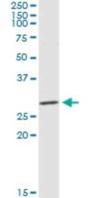 Western Blot: CLEC9a Antibody [H00283420-D01P] - Analysis of CLEC9A expression in mouse kidney.