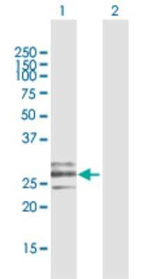 Western Blot: CLEC9a Antibody [H00283420-D01P] - Analysis of CLEC9A expression in transfected 293T cell line by CLEC9A polyclonal antibody.Lane 1: CLEC9A transfected lysate(27.30 KDa).Lane 2: Non-transfected lysate.