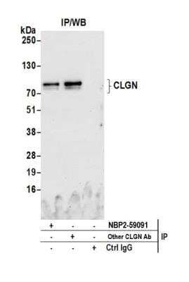 Immunoprecipitation: CLGN Antibody [NBP2-59091] - Detection of human CLGN by western blot of immunoprecipitates. Samples: Whole cell lysate (0.5 or 1.0 mg per IP reaction; 20% of IP loaded) from HeLa cells prepared using NETN lysis buffer. Antibodies: Affinity purified rabbit anti-CLGN antibody NBP2-59091 used for IP at 8 ul per reaction. CLGN was also immunoprecipitated by another rabbit anti-CLGN antibody. For blotting immunoprecipitated CLGN, NBP2-59091 was used at 1:1000. Detection: Chemiluminescence with an exposure time of 75 seconds.