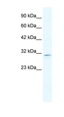Western Blot: CLIC2 Antibody [NBP1-80058] - HepG2 cell lysate, concentration 1.25ug/ml.