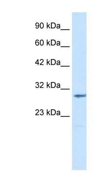 Western Blot: CLIC2 Antibody [NBP1-80059] - Jurkat cell lysate, concentration 1.25ug/ml.