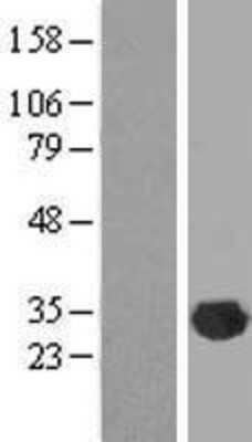 Western Blot CLIC2 Overexpression Lysate