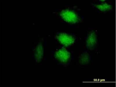 Immunocytochemistry/Immunofluorescence: CLIC3 Antibody [H00009022-B01P] - Analysis of purified antibody to CLIC3 on HeLa cell. (antibody concentration 10 ug/ml)