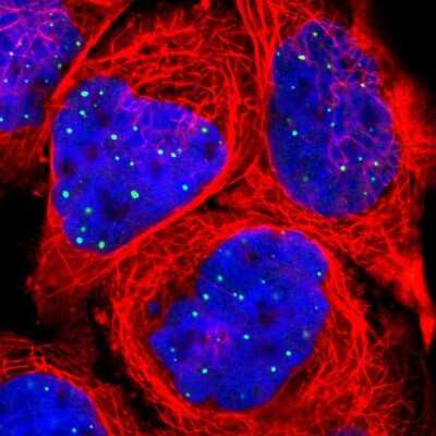 <b>Orthogonal Strategies Validation. </b>Immunocytochemistry/Immunofluorescence: CLIC3 Antibody [NBP1-89465] - Immunofluorescent staining of human cell line A-431 shows localization to nuclear bodies. Antibody staining is shown in green. 