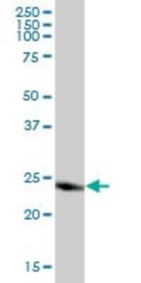 Western Blot: CLIC3 Antibody [H00009022-B01P] - Analysis of CLIC3 expression in human pancreas.