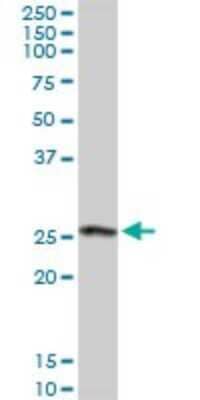 Western Blot: CLIC3 Antibody [H00009022-D01P] - Analysis of CLIC3 expression in human placenta.