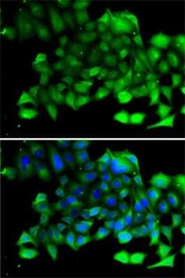Immunocytochemistry/Immunofluorescence: CLIC4 Antibody [NBP2-92908] - Analysis of A-549 cells using CLIC4 . Blue: DAPI for nuclear staining.