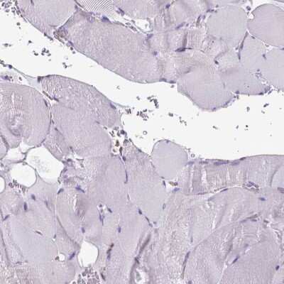 Immunohistochemistry-Paraffin: CLIC4 Antibody [NBP2-49321] - Staining of human skeletal muscle shows low expression as expected.