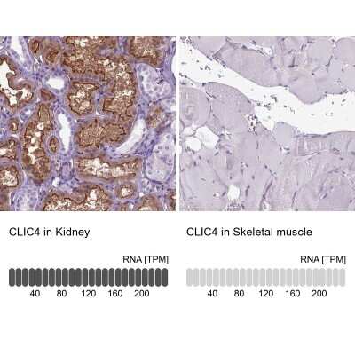 <b>Orthogonal Strategies Validation. </b>Immunohistochemistry-Paraffin: CLIC4 Antibody [NBP2-49321] - Staining in human kidney and skeletal muscle tissues using anti-CLIC4 antibody. Corresponding CLIC4 RNA-seq data are presented for the same tissues.