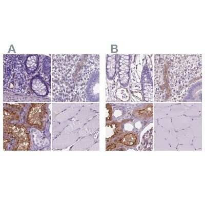 <b>Independent Antibodies Validation. </b>Immunohistochemistry-Paraffin: CLIC4 Antibody [NBP2-49321] - Staining of human colon, endometrium, kidney and skeletal muscle using Anti-CLIC4 antibody NBP2-49321 (A) shows similar protein distribution across tissues to independent antibody NBP1-85574 (B).