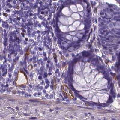 Immunohistochemistry-Paraffin: CLIC4 Antibody [NBP2-49321] - Staining of human colon.